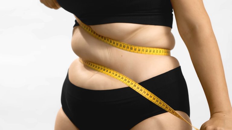 Tratamento para obesidade e risco cardiovascular em Garanhuns