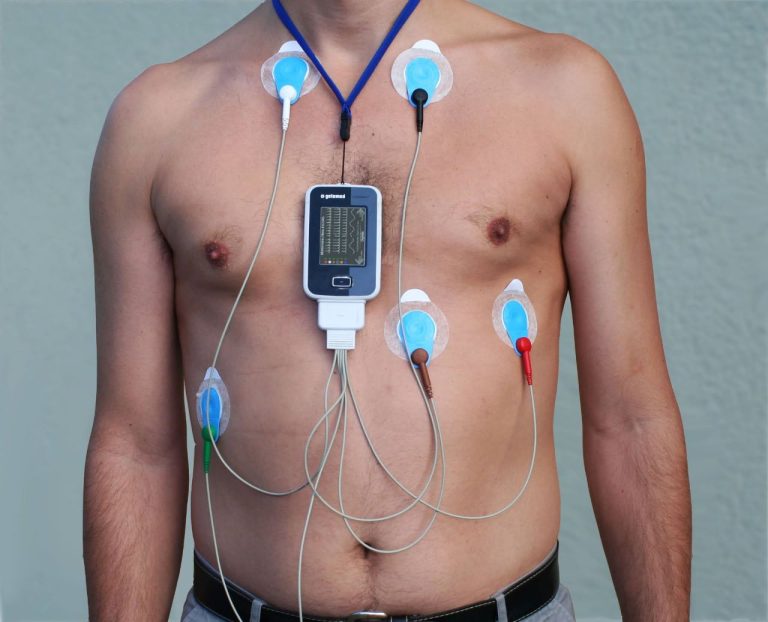 Holter de 24h cardíaco